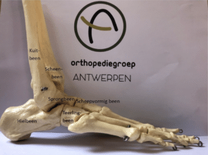 artroza deformată a articulației gleznei